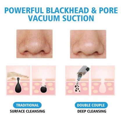 Electric Suction Blackhead Instrument EmartValue