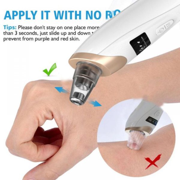 Electric Suction Blackhead Instrument EmartValue