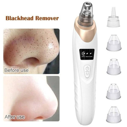 Electric Suction Blackhead Instrument EmartValue